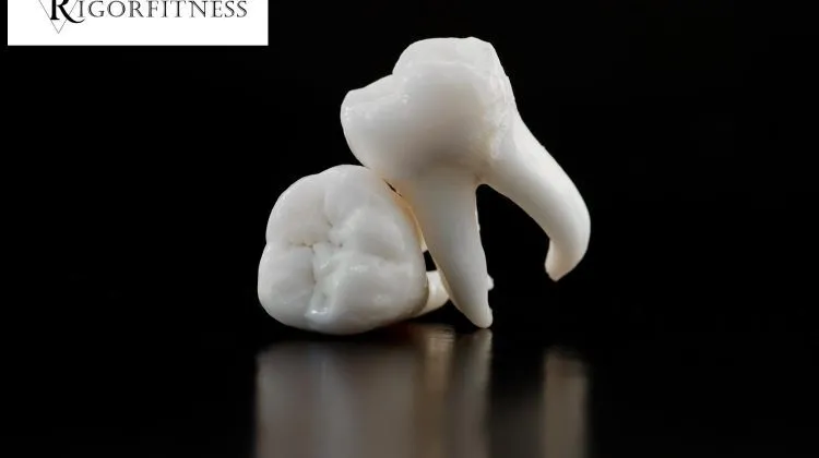 How to Protect Your Teeth from Damage While Lifting Weights
